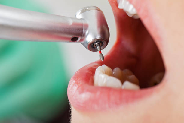 Best Emergency Tooth Extraction  in Park Hill, OK